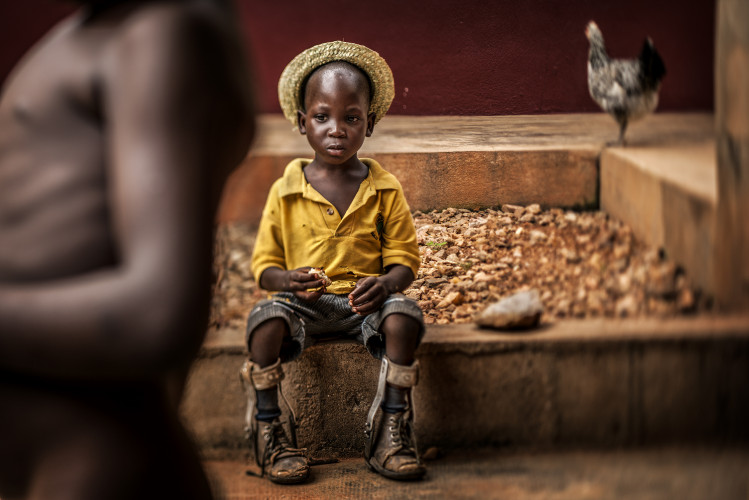 Digigraphie-Interview-Reihe: Antonio Aragon – Gewinner des Unicef-Foto des Jahres